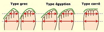 Différentes formes de pieds