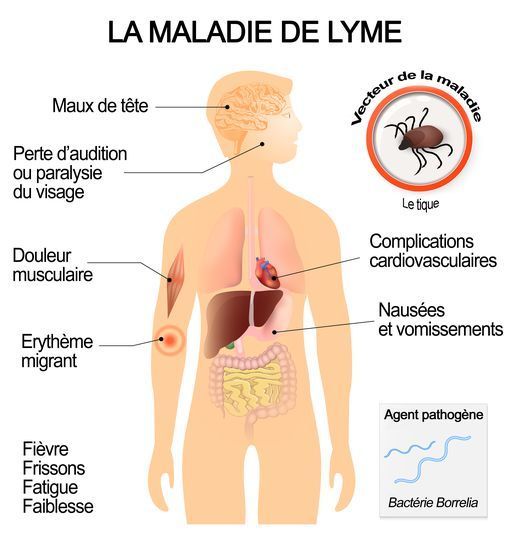 Les symptomes et les complications de la maladie de Lyme